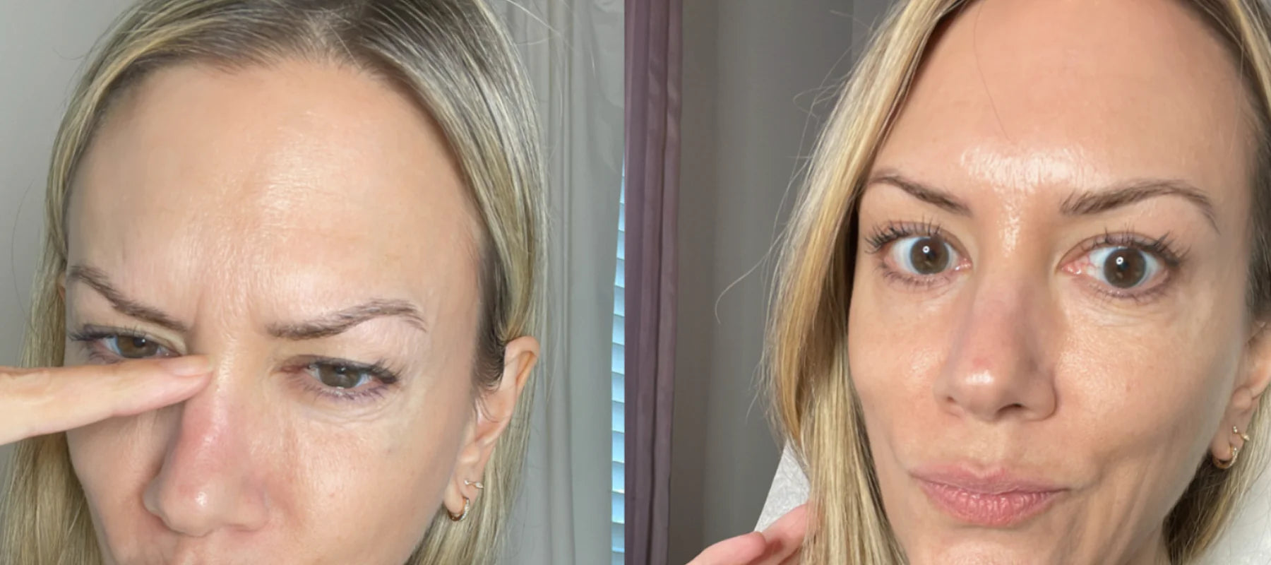 Taping facial avec des patchs en silicone de qualité médicale à 100%